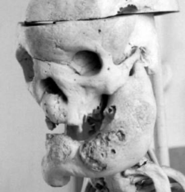 Pathological Anatomy Collection
